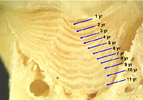 Figure 1b. Estimate of age in the laboratory by counting cement deposition layers on the root pad of the first permanent molar teeth of the mandible in Figure 1a. Each band corresponds with a year of age.